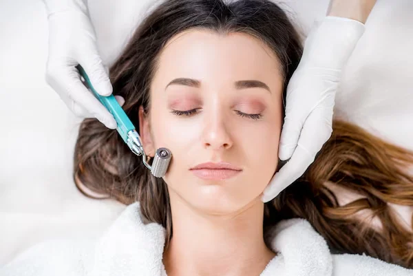 Dermaroller Treatment
