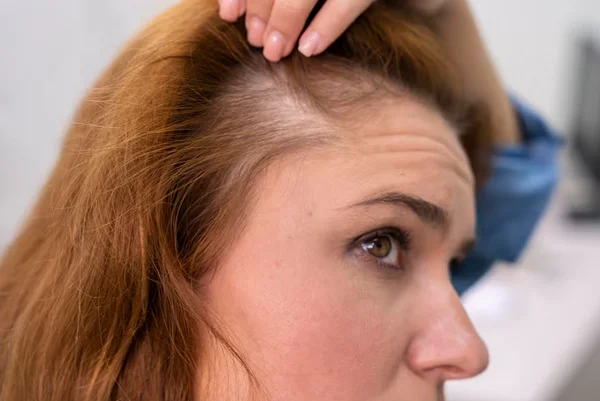 Hair Loss Treatment