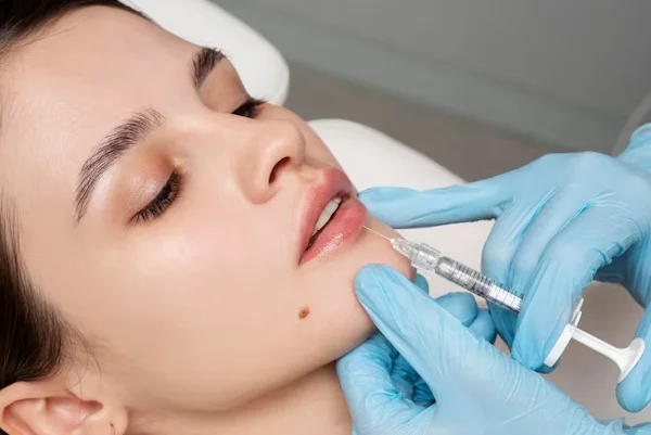 Cutaneous Fillers